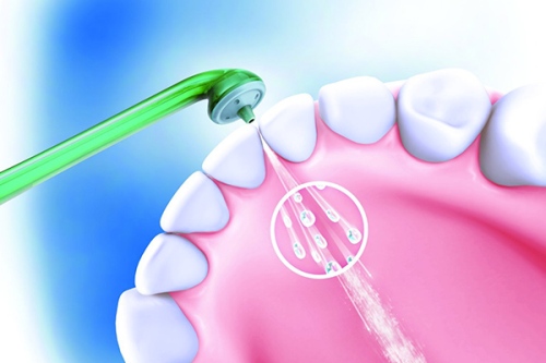 jet-detnaire Эффективные способы защитить свои зубы от бактерий